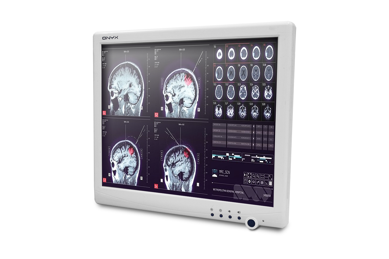 SMA-1733